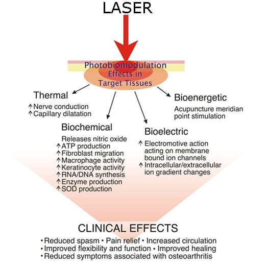 Laser Therapy Breakdown
